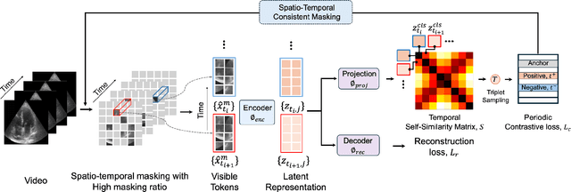 Figure 2 for EchoFM: Foundation Model for Generalizable Echocardiogram Analysis