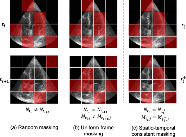 Figure 3 for EchoFM: Foundation Model for Generalizable Echocardiogram Analysis