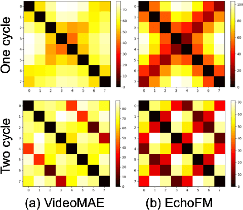 Figure 4 for EchoFM: Foundation Model for Generalizable Echocardiogram Analysis