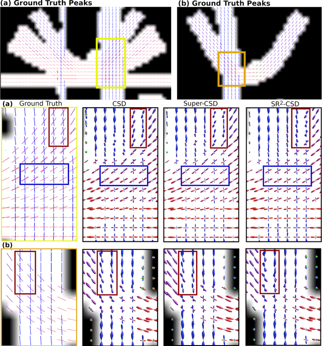 Figure 3 for Spatially Regularized Super-Resolved Constrained Spherical Deconvolution (SR$^2$-CSD) of Diffusion MRI Data