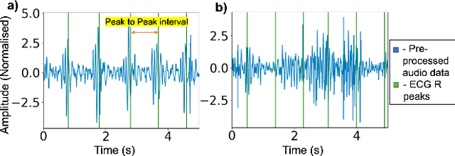 Figure 1 for Heart Rate Extraction from Abdominal Audio Signals