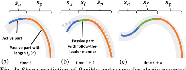 Figure 3 for Autonomous Intelligent Navigation for Flexible Endoscopy Using Monocular Depth Guidance and 3-D Shape Planning