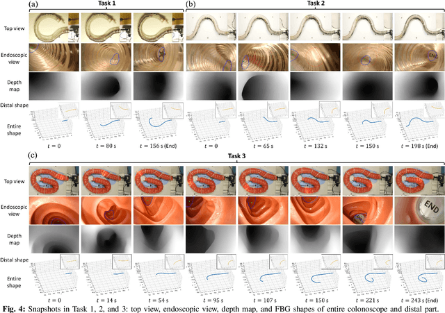 Figure 4 for Autonomous Intelligent Navigation for Flexible Endoscopy Using Monocular Depth Guidance and 3-D Shape Planning