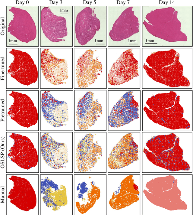 Figure 4 for Learning from Similarity Proportion Loss for Classifying Skeletal Muscle Recovery Stages