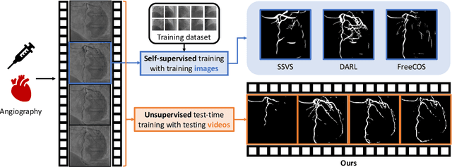 Figure 1 for DeNVeR: Deformable Neural Vessel Representations for Unsupervised Video Vessel Segmentation