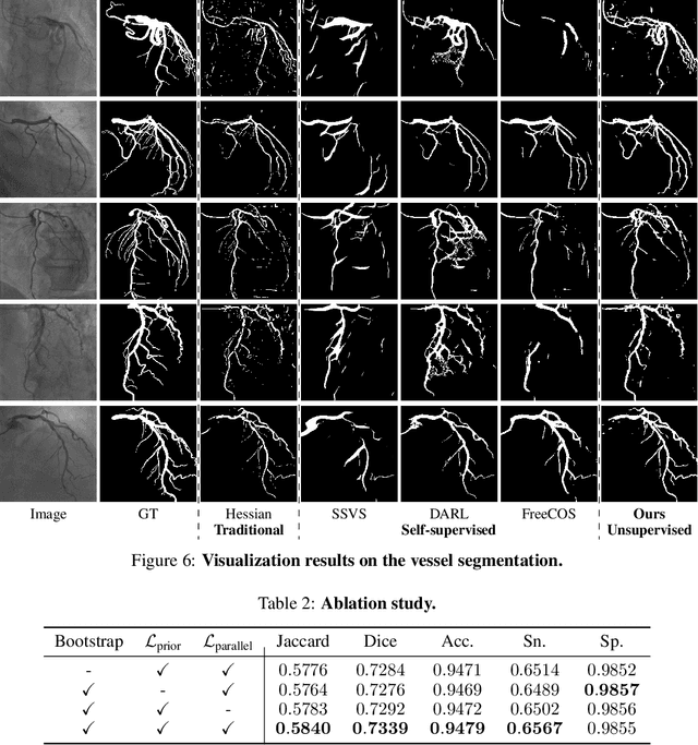 Figure 4 for DeNVeR: Deformable Neural Vessel Representations for Unsupervised Video Vessel Segmentation