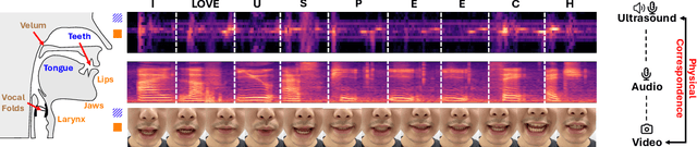 Figure 3 for USpeech: Ultrasound-Enhanced Speech with Minimal Human Effort via Cross-Modal Synthesis