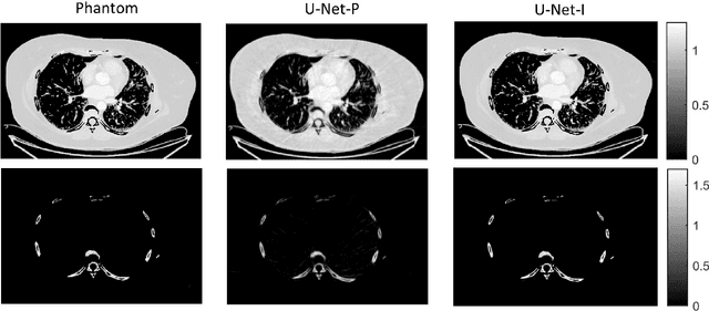 Figure 3 for Systematic Review on Learning-based Spectral CT