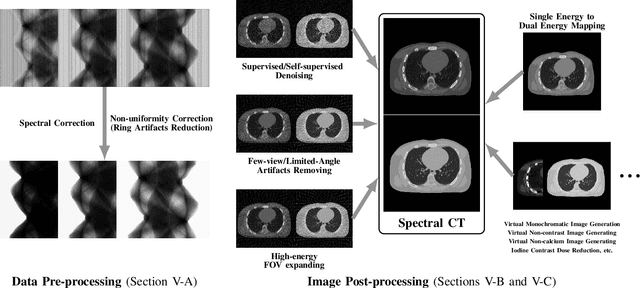 Figure 4 for Systematic Review on Learning-based Spectral CT