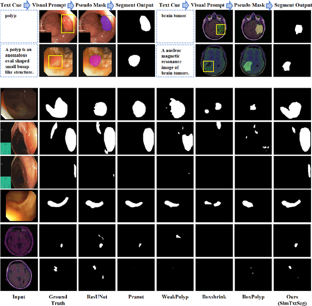 Figure 4 for SimTxtSeg: Weakly-Supervised Medical Image Segmentation with Simple Text Cues