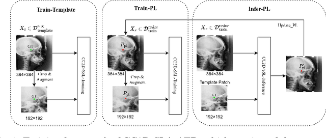 Figure 1 for Landmarks Are Alike Yet Distinct: Harnessing Similarity and Individuality for One-Shot Medical Landmark Detection