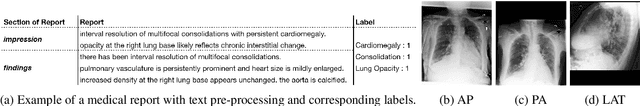 Figure 1 for GIT-CXR: End-to-End Transformer for Chest X-Ray Report Generation