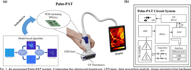 Figure 1 for Hardware Architecture Design of Model-Based Image Reconstruction Towards Palm-size Photoacoustic Tomography