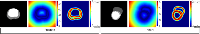 Figure 3 for Boundary-weighted logit consistency improves calibration of segmentation networks