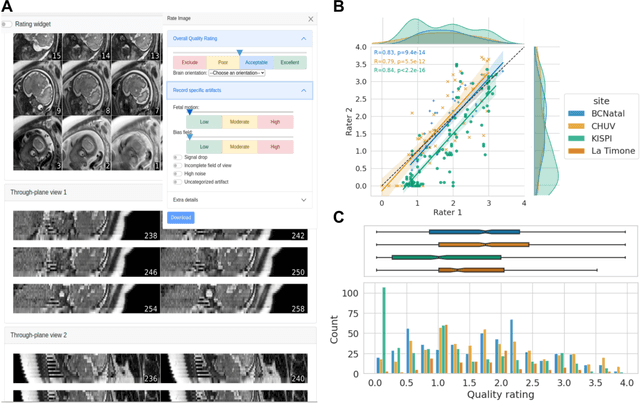 Figure 4 for FetMRQC: an open-source machine learning framework for multi-centric fetal brain MRI quality control