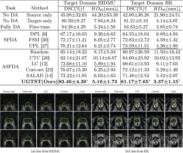 Figure 2 for An Uncertainty-guided Tiered Self-training Framework for Active Source-free Domain Adaptation in Prostate Segmentation