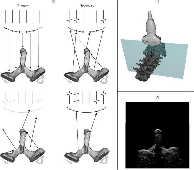 Figure 1 for UltraRay: Full-Path Ray Tracing for Enhancing Realism in Ultrasound Simulation