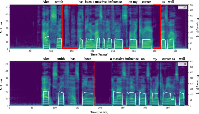 Figure 1 for PauseSpeech: Natural Speech Synthesis via Pre-trained Language Model and Pause-based Prosody Modeling