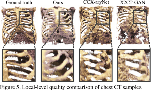 Figure 4 for Unaligned 2D to 3D Translation with Conditional Vector-Quantized Code Diffusion using Transformers