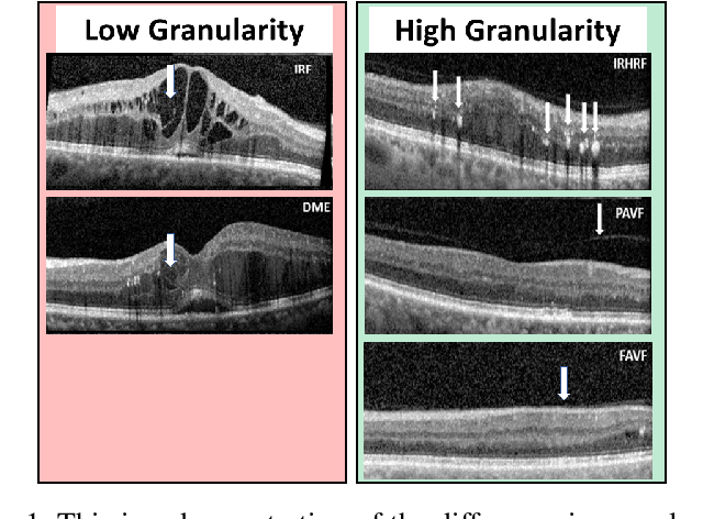 Figure 1 for Clinically Labeled Contrastive Learning for OCT Biomarker Classification