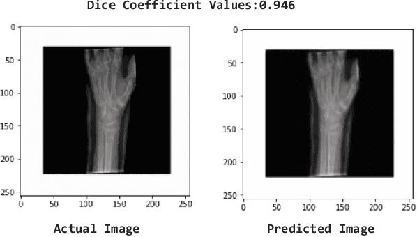 Figure 4 for Advancing Healthcare: Innovative ML Approaches for Improved Medical Imaging in Data-Constrained Environments