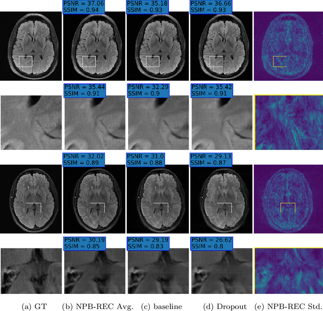 Figure 4 for NPB-REC: A Non-parametric Bayesian Deep-learning Approach for Undersampled MRI Reconstruction with Uncertainty Estimation