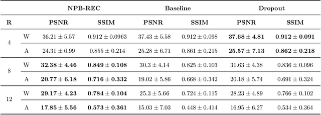 Figure 3 for NPB-REC: A Non-parametric Bayesian Deep-learning Approach for Undersampled MRI Reconstruction with Uncertainty Estimation