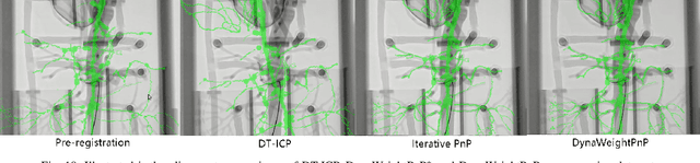 Figure 2 for DynaWeightPnP: Toward global real-time 3D-2D solver in PnP without correspondences