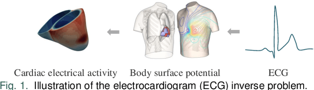 Figure 1 for Solving the Inverse Problem of Electrocardiography for Cardiac Digital Twins: A Survey