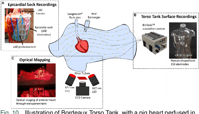 Figure 2 for Solving the Inverse Problem of Electrocardiography for Cardiac Digital Twins: A Survey