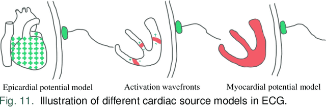 Figure 3 for Solving the Inverse Problem of Electrocardiography for Cardiac Digital Twins: A Survey