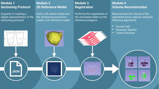 Figure 1 for Volumetric Reconstruction of Prostatectomy Specimens from Histology