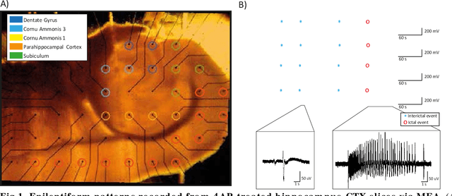 Figure 2 for Semantic segmentation for recognition of epileptiform patterns recorded via Microelectrode Arrays in vitro