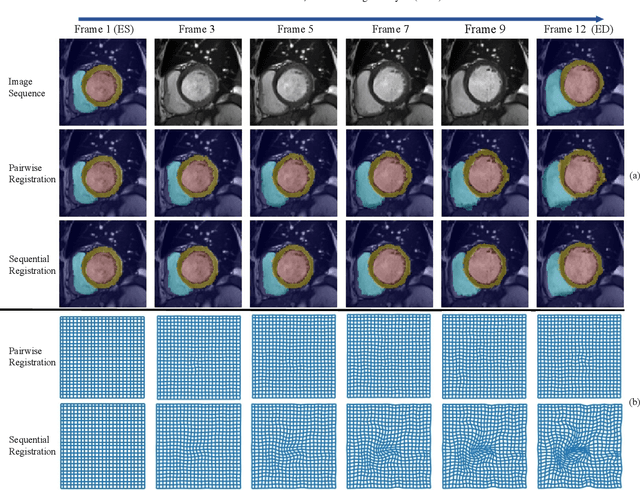 Figure 2 for Neural Ordinary Differential Equation based Sequential Image Registration for Dynamic Characterization