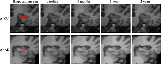 Figure 4 for Neural Ordinary Differential Equation based Sequential Image Registration for Dynamic Characterization