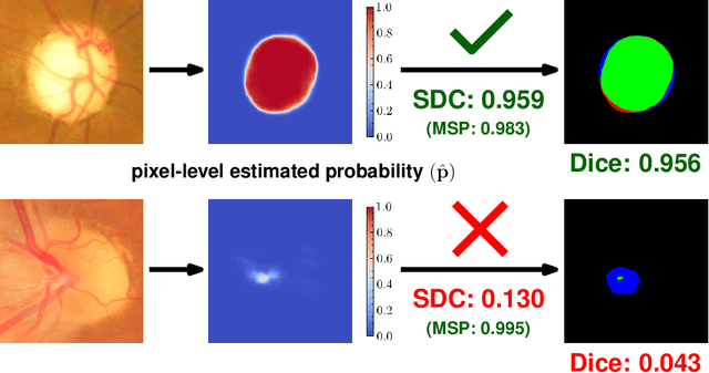 Figure 1 for Selective Prediction for Semantic Segmentation using Post-Hoc Confidence Estimation and Its Performance under Distribution Shift