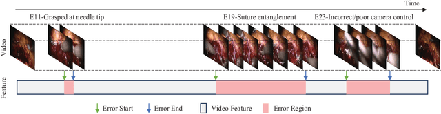 Figure 1 for SEDMamba: Enhancing Selective State Space Modelling with Bottleneck Mechanism and Fine-to-Coarse Temporal Fusion for Efficient Error Detection in Robot-Assisted Surgery