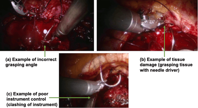 Figure 2 for SEDMamba: Enhancing Selective State Space Modelling with Bottleneck Mechanism and Fine-to-Coarse Temporal Fusion for Efficient Error Detection in Robot-Assisted Surgery