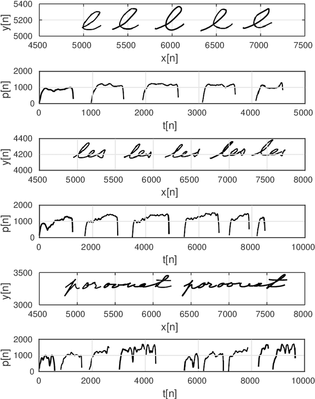 Figure 4 for Evaluation of handwriting kinematics and pressure for differential diagnosis of Parkinson's disease