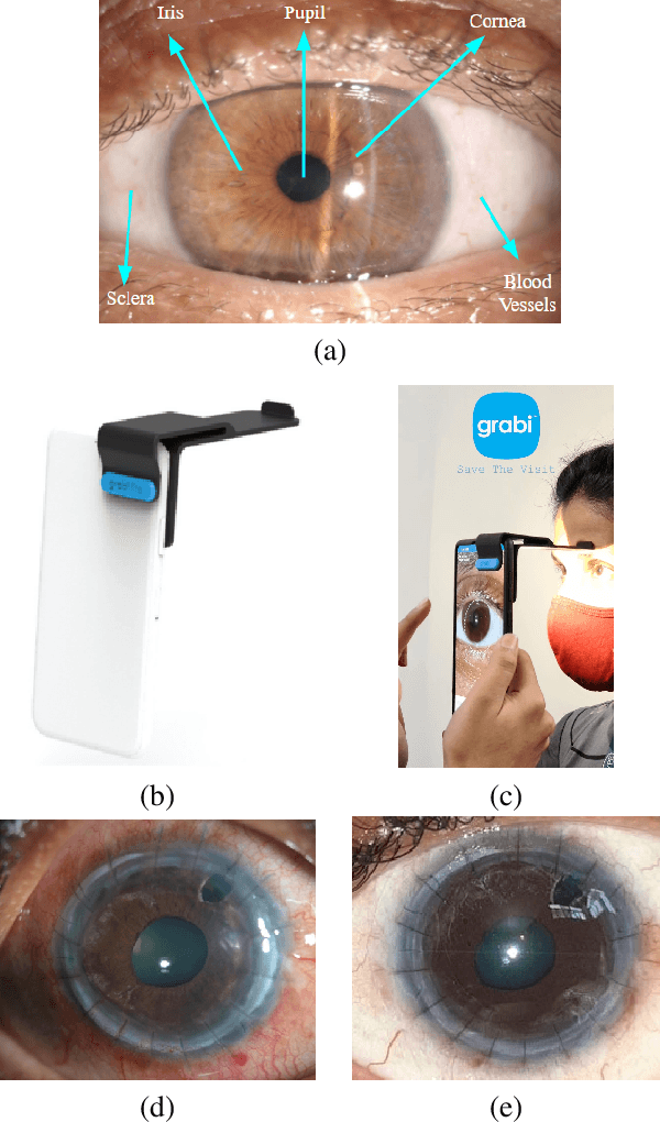 Figure 1 for Next-Generation Teleophthalmology: AI-enabled Quality Assessment Aiding Remote Smartphone-based Consultation