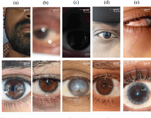 Figure 2 for Next-Generation Teleophthalmology: AI-enabled Quality Assessment Aiding Remote Smartphone-based Consultation