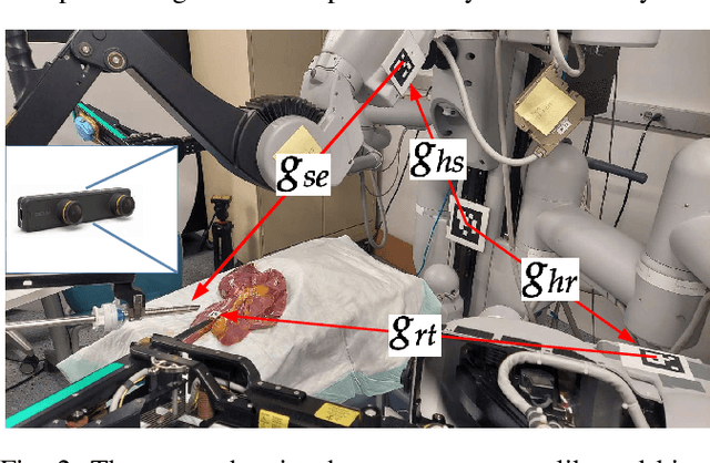 Figure 2 for A Framework For Automated Dissection Along Tissue Boundary