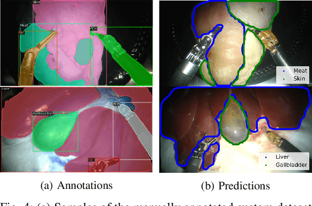 Figure 4 for A Framework For Automated Dissection Along Tissue Boundary