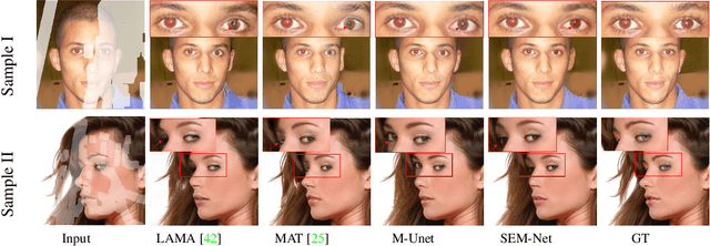 Figure 1 for SEM-Net: Efficient Pixel Modelling for image inpainting with Spatially Enhanced SSM