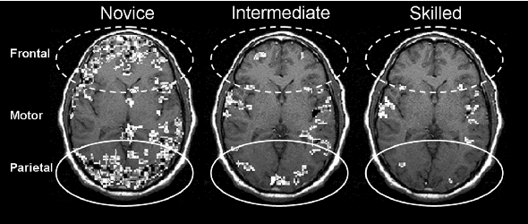 Figure 1 for Two Heads are Better than One: A Bio-inspired Method for Improving Classification on EEG-ET Data