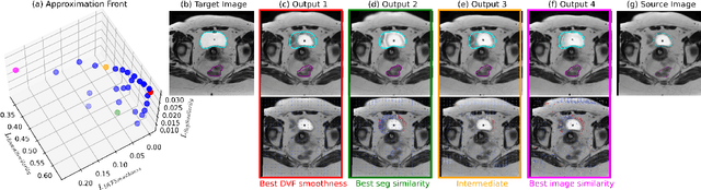 Figure 3 for Multi-Objective Learning for Deformable Image Registration