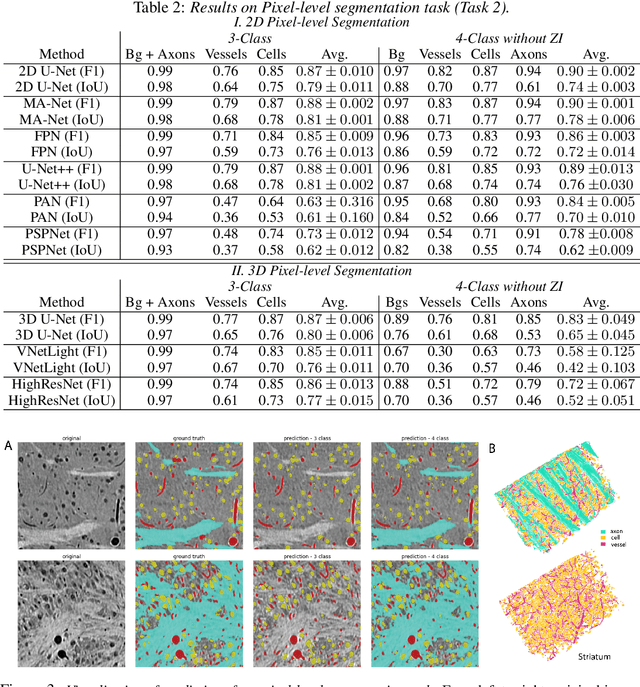 Figure 4 for MTNeuro: A Benchmark for Evaluating Representations of Brain Structure Across Multiple Levels of Abstraction