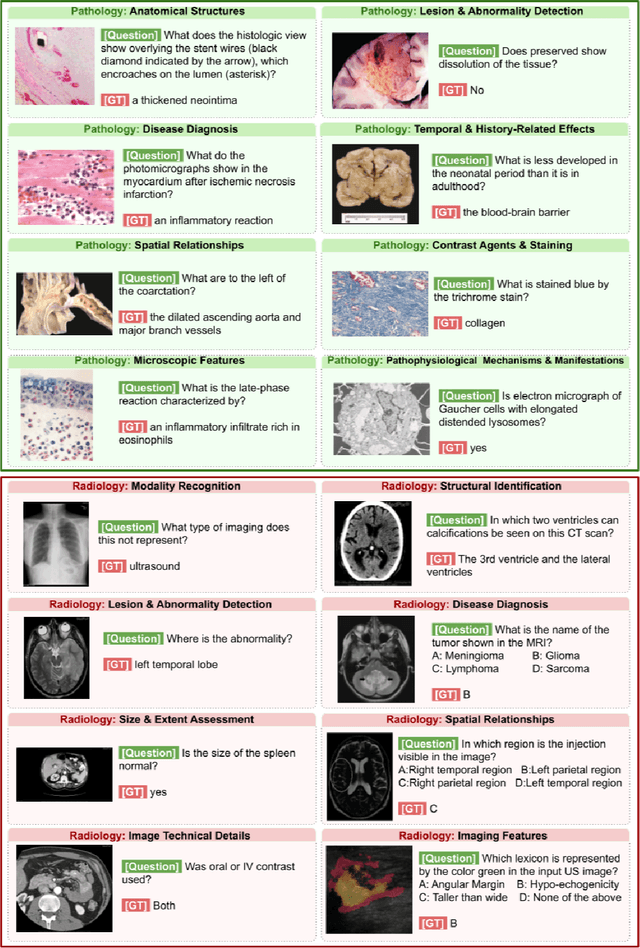 Figure 3 for Multimodal ChatGPT for Medical Applications: an Experimental Study of GPT-4V