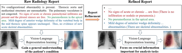 Figure 1 for Enhancing the vision-language foundation model with key semantic knowledge-emphasized report refinement