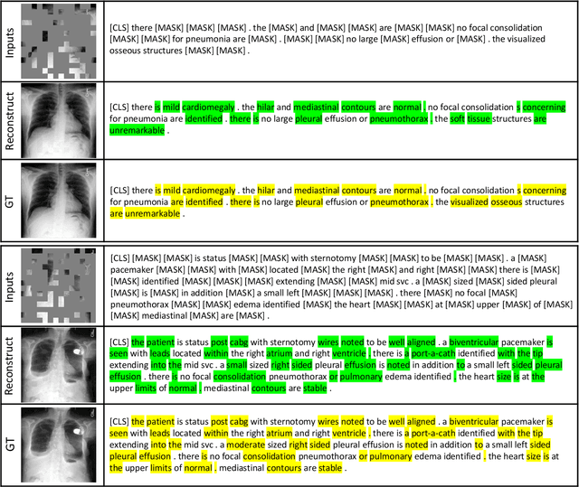 Figure 4 for Multi-task Paired Masking with Alignment Modeling for Medical Vision-Language Pre-training